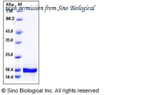 Sino Biological 10247-HNAB image 1