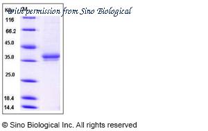 Sino Biological 13094-H08H image 1