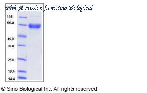 Sino Biological 50808-M02H image 1