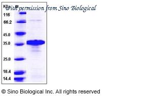 Sino Biological 12488-HNCE image 1