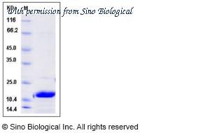 Sino Biological 13203-HNCE image 1