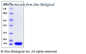 Sino Biological 50957-M08H image 1