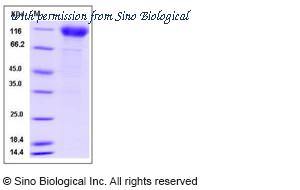 Sino Biological 13222-H02H image 1