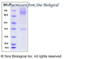 Sino Biological 50956-M02H image 1