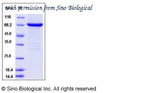 Sino Biological 10824-H20B1 image 1