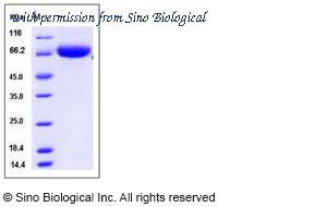 Sino Biological 51093-M02H image 1