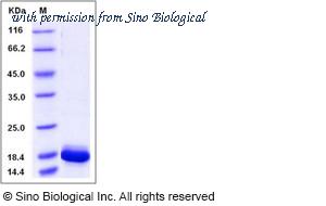 Sino Biological 10124-H07E1 image 1