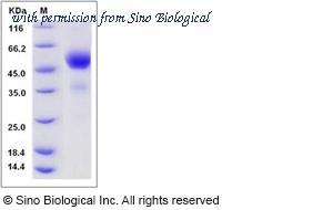 Sino Biological 50939-M02H image 1