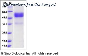 Sino Biological 13387-H02H image 1