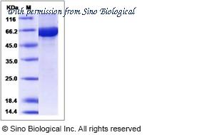 Sino Biological 15659-H20B image 1