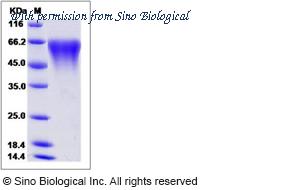 Sino Biological 13365-H08H image 1