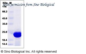 Sino Biological 14666-H07E image 1