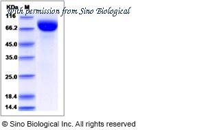 Sino Biological 15661-H08H image 1