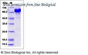 Sino Biological 15669-H20B image 1