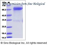 Sino Biological 13968-H02H1 image 1