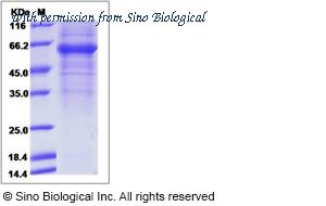 Sino Biological 14155-H01H image 1