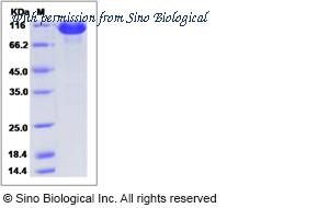 Sino Biological 80465-R02H image 1