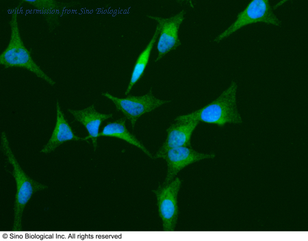 Sino Biological 10870-MM01 image 1