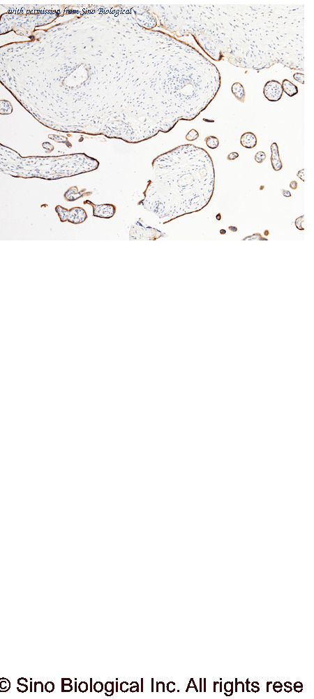Sino Biological 10628-MM07 image 1