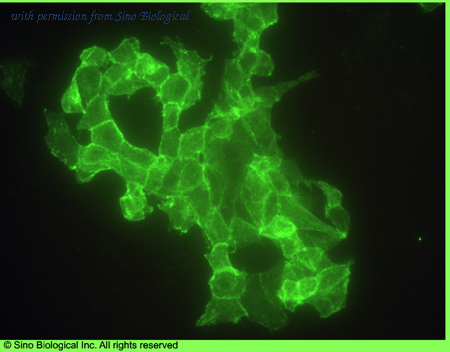 Sino Biological 10428-MM02 image 1