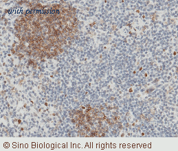 Sino Biological 10259-R110 image 1