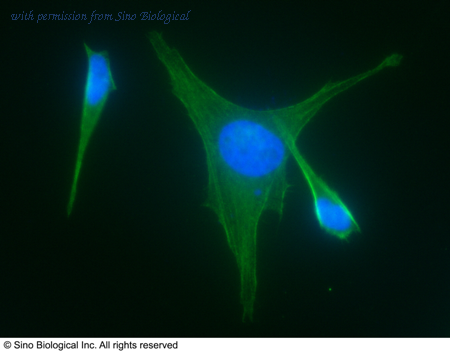 Sino Biological 10745-R004 image 1