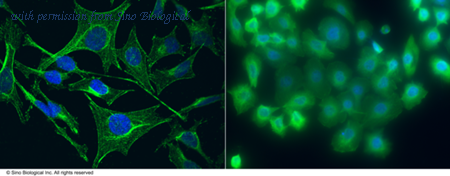 Sino Biological 11142-MM04 image 1
