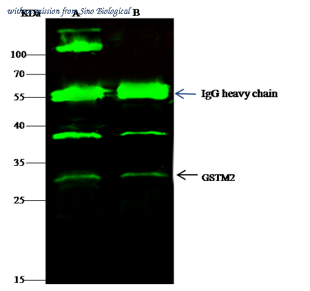 Sino Biological 12042-R006 image 1