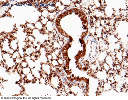 Sino Biological 50205-R119 image 1