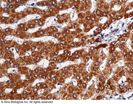 Sino Biological 10295-MM07 image 1