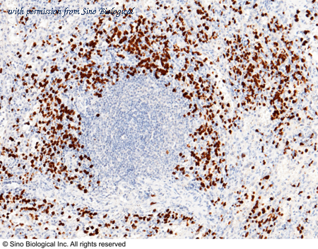 Sino Biological 12635-R116 image 1