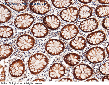 Sino Biological 10384-R214 image 1