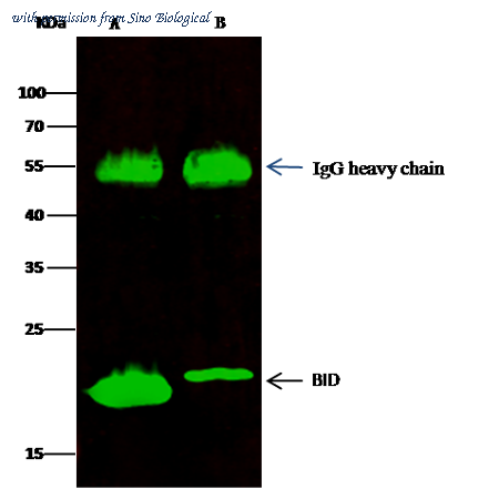 Sino Biological 10468-R002 image 1