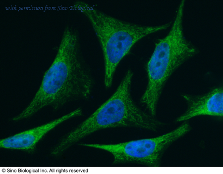 Sino Biological 10468-R005 image 1
