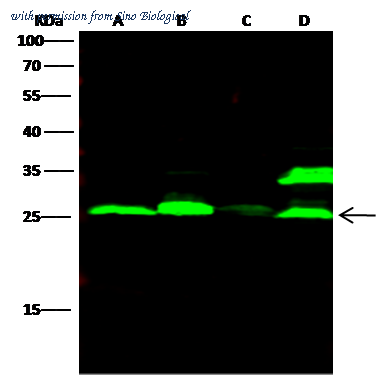 Sino Biological 10486-R221 image 1
