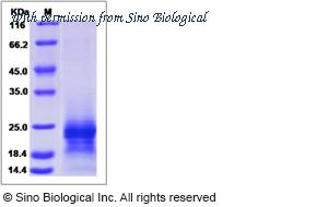 Sino Biological 15441-H08H image 1