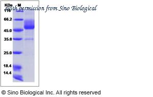 Sino Biological 12123-H05H image 1