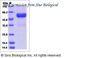 Sino Biological 11845-H02H image 1