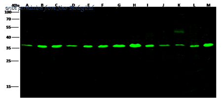 Sino Biological 100242-MM05 image 1