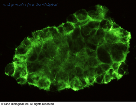 Sino Biological 10148-R007 image 1