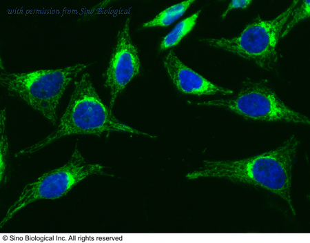 Sino Biological 10339-MM12 image 1