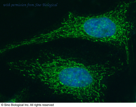 Sino Biological 11640-R077 image 1
