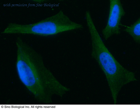 Sino Biological 14293-MM08 image 1