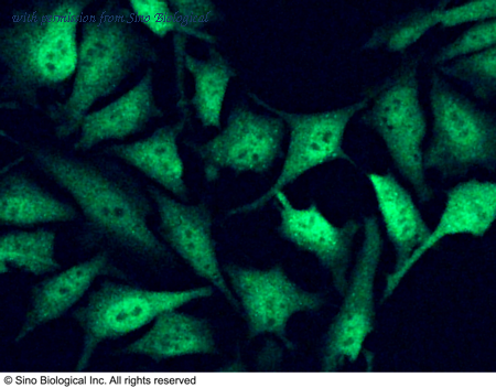 Sino Biological 14434-R104 image 1
