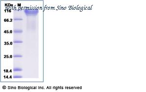 Sino Biological 11958-HNAH image 1