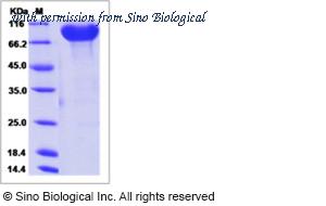 Sino Biological 16033-H02H image 1