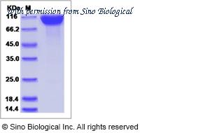 Sino Biological 17051-H02H image 1