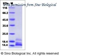 Sino Biological 40471-V08Y3 image 1