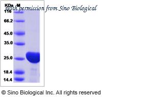 Sino Biological 80583-R07E image 1