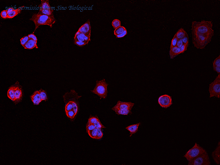 Sino Biological 12206-MM01 image 1